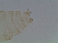 Macrobiotus anderssoni image