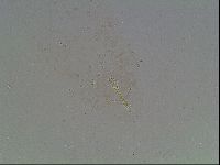 Macrobiotus anderssoni image