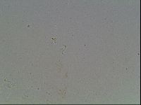 Macrobiotus anderssoni image
