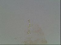 Macrobiotus anderssoni image