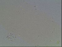 Macrobiotus anderssoni image