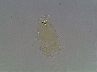 Macrobiotus anderssoni image