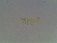 Macrobiotus anderssoni image