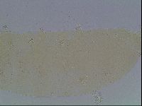 Macrobiotus anderssoni image