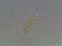 Macrobiotus anderssoni image