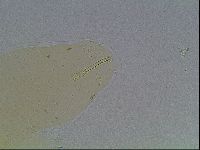 Macrobiotus anderssoni image