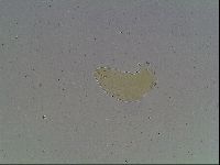 Macrobiotus anderssoni image