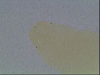 Macrobiotus anderssoni image