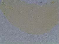 Macrobiotus anderssoni image