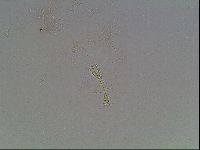 Macrobiotus anderssoni image
