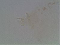 Macrobiotus anderssoni image