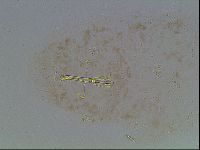 Macrobiotus anderssoni image