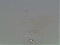 Macrobiotus anderssoni image