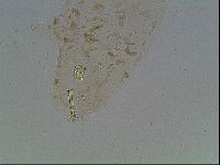 Macrobiotus anderssoni image