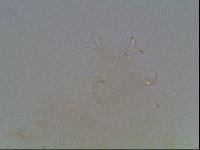 Macrobiotus anderssoni image