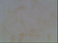 Macrobiotus anderssoni image
