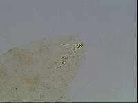Macrobiotus anderssoni image