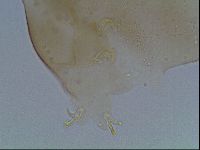 Macrobiotus anderssoni image
