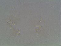 Macrobiotus anderssoni image