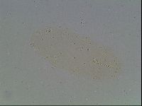 Macrobiotus anderssoni image