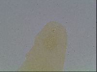 Macrobiotus anderssoni image