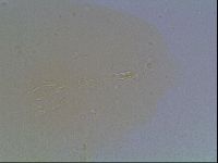 Macrobiotus anderssoni image