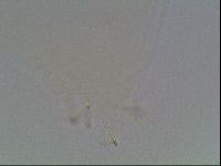 Macrobiotus anderssoni image