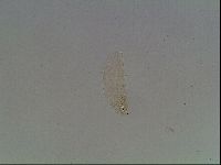 Macrobiotus anderssoni image