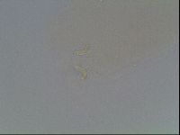 Macrobiotus anderssoni image