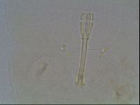 Macrobiotus anderssoni image