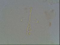 Macrobiotus anderssoni image
