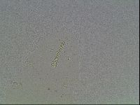 Macrobiotus anderssoni image