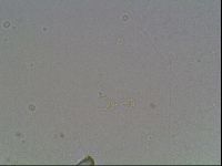 Macrobiotus anderssoni image