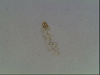 Macrobiotus anderssoni image