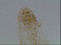 Macrobiotus anderssoni image