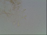 Macrobiotus anderssoni image