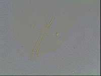 Macrobiotus anderssoni image