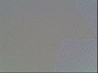 Macrobiotus anderssoni image