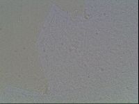 Macrobiotus anderssoni image