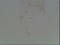 Macrobiotus anderssoni image