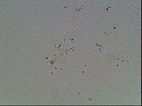 Macrobiotus anderssoni image
