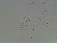 Macrobiotus anderssoni image