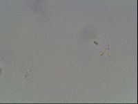 Macrobiotus anderssoni image