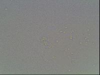Macrobiotus anderssoni image