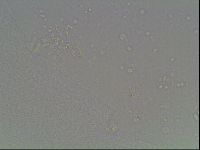 Macrobiotus anderssoni image
