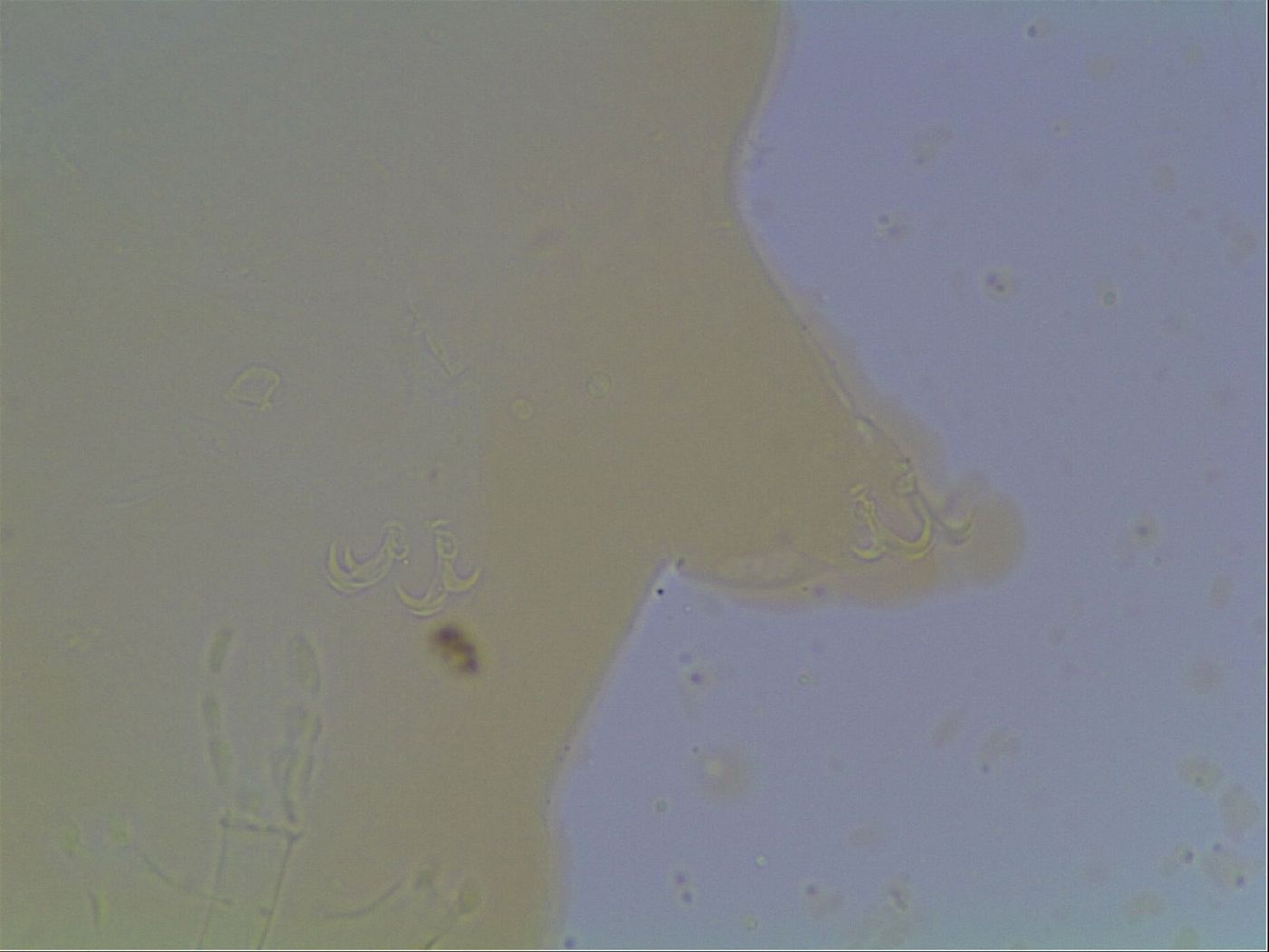 Paramacrobiotus areolatus image