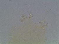 Paramacrobiotus areolatus image