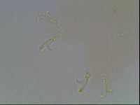 Paramacrobiotus areolatus image