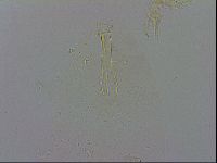 Minibiotus aculeatus image