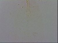 Minibiotus aculeatus image